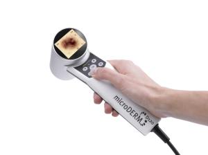 microDERM&reg;-Kamera (&copy; Visiomed AG)